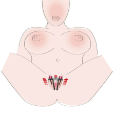 Pinzas Vaginales Intimate Spreader Strong