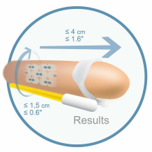 Androextender Extensor de Pene